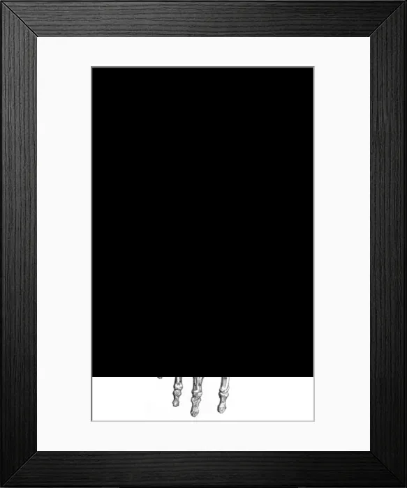 Framed Print : Muscles of Hand and Foot Framed Print : Muscles of Hand and Foot