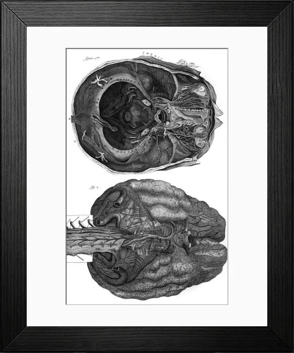 Framed Print : Brain & Cerebellum 18Th Framed Print : Brain & Cerebellum 18Th