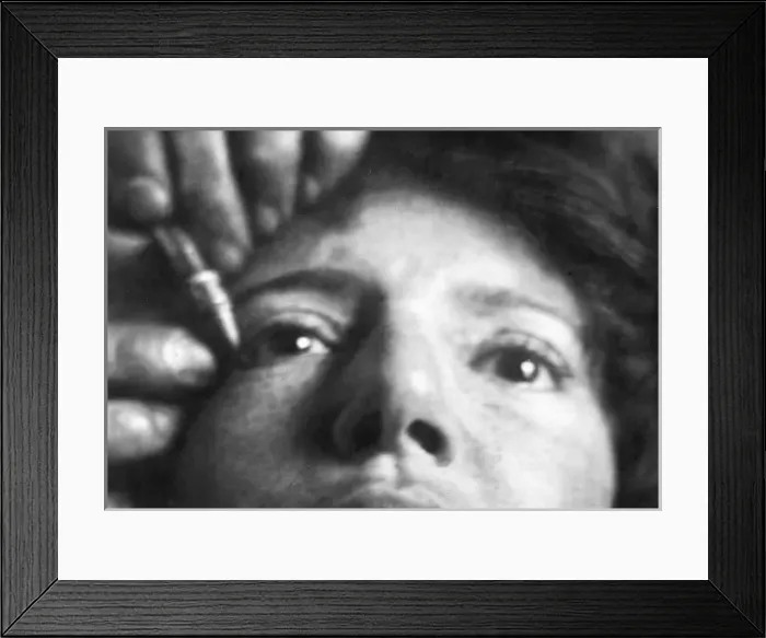 Framed Print : Tattooing an Eyelid Framed Print : Tattooing an Eyelid