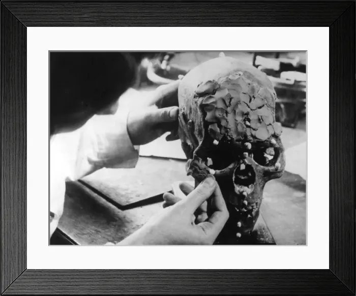 Framed Print : Skull Reconstruction Framed Print : Skull Reconstruction