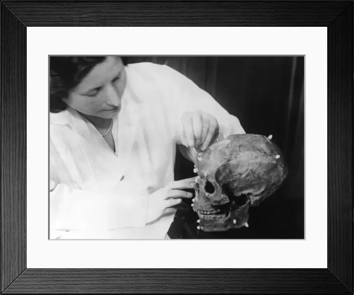Framed Print : Skull Reconstruction Framed Print : Skull Reconstruction