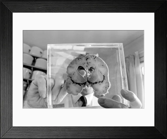 Framed Print : Dr Jan Corsellis Framed Print : Dr Jan Corsellis