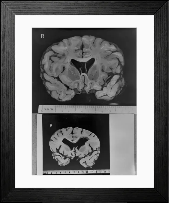 Framed Print : Dr Jan Corsellis Framed Print : Dr Jan Corsellis