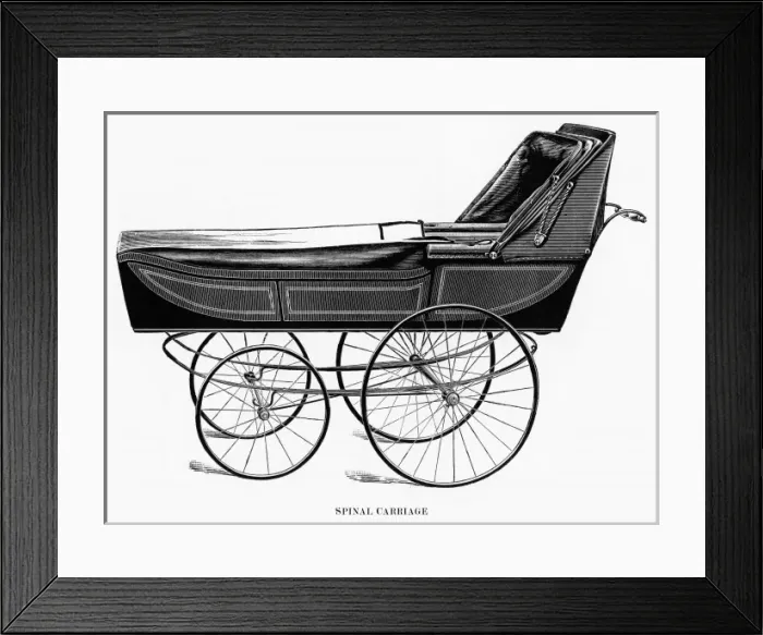 Framed Print : Spinal carriage Framed Print : Spinal carriage