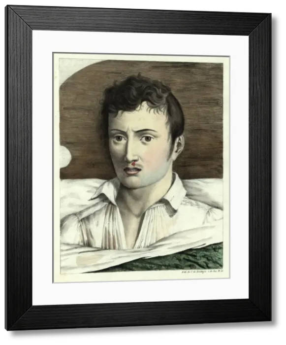 Framed Print : In bed with yellow fever Framed Print : In bed with yellow fever