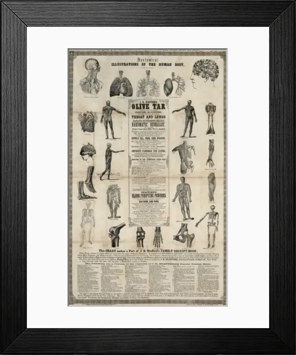 Framed Print : Anatomical, illustrations of the human body Framed Print : Anatomical, illustrations of the human body