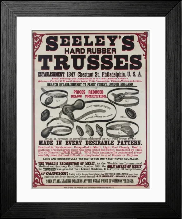 Framed Print : Seeley s. Hard rubber. Trusses Framed Print : Seeley s. Hard rubber. Trusses