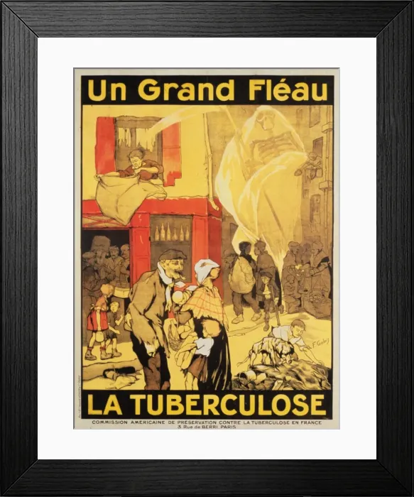 Framed Print : Un grand fleau la tuberculose Framed Print : Un grand fleau la tuberculose