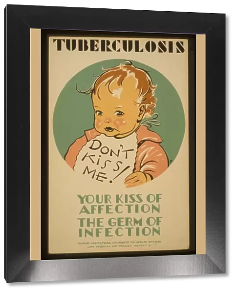 Tuberculosis Don t kiss me! : Your kiss of affection - the g