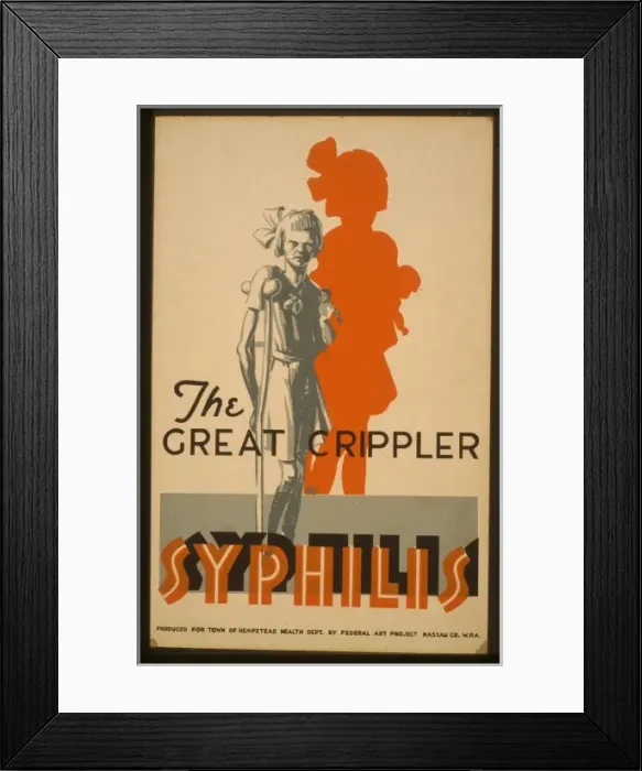 Framed Print : The great crippler - syphilis Framed Print : The great crippler - syphilis