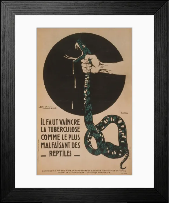 Framed Print : Il faut vaincre la tuberculose comme le plus malfaisant des Framed Print : Il faut vaincre la tuberculose comme le plus malfaisant des