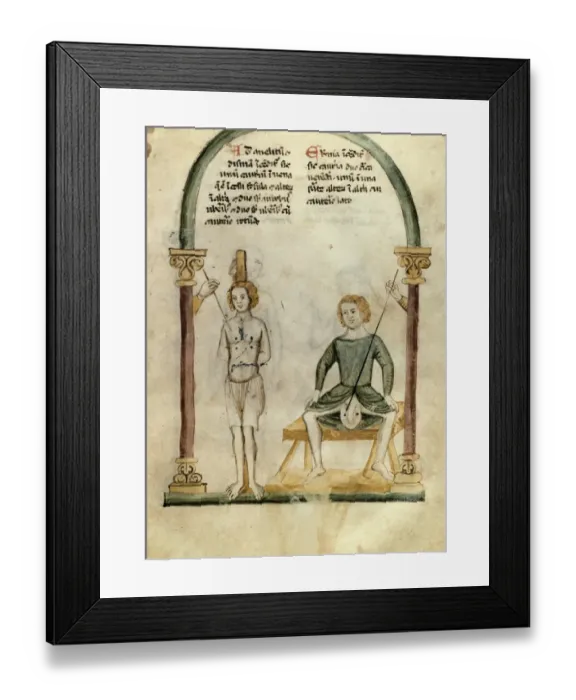 Framed Print : Cauterization and preparation. Miniature. Ms. Rawlinson Framed Print : Cauterization and preparation. Miniature. Ms. Rawlinson