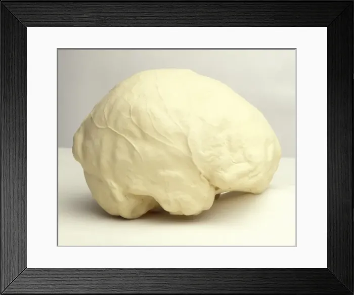Framed Print : Homo sapiens brain Framed Print : Homo sapiens brain