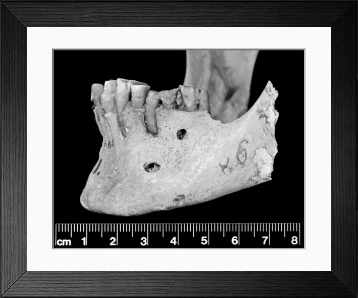 Framed Print : Lateral view of mandible Framed Print : Lateral view of mandible