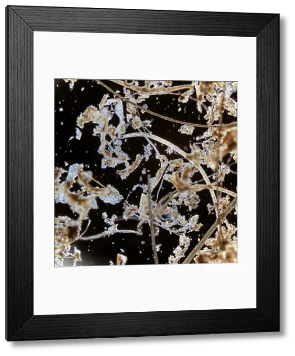 Framed Print : Trichinella spiralis, parasitic roundworm Framed Print : Trichinella spiralis, parasitic roundworm