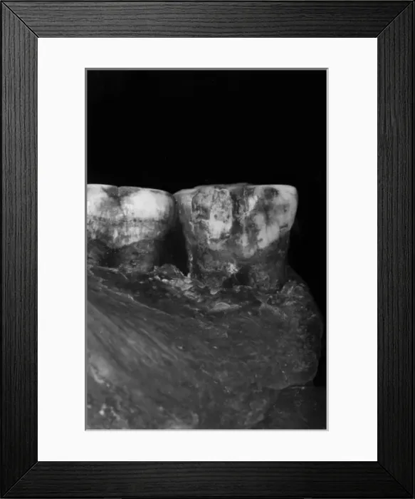 Framed Print : Piltdown 1 molars Framed Print : Piltdown 1 molars