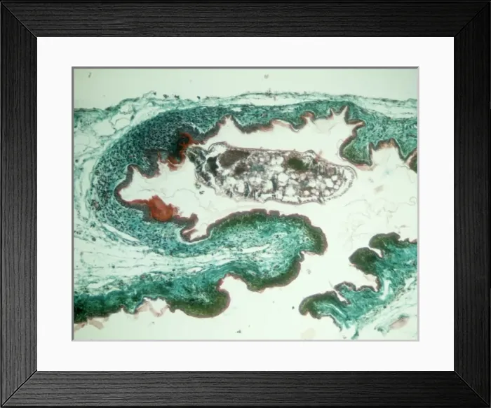 Framed Print : Chiggers, larvae of trombiculid mites Framed Print : Chiggers, larvae of trombiculid mites