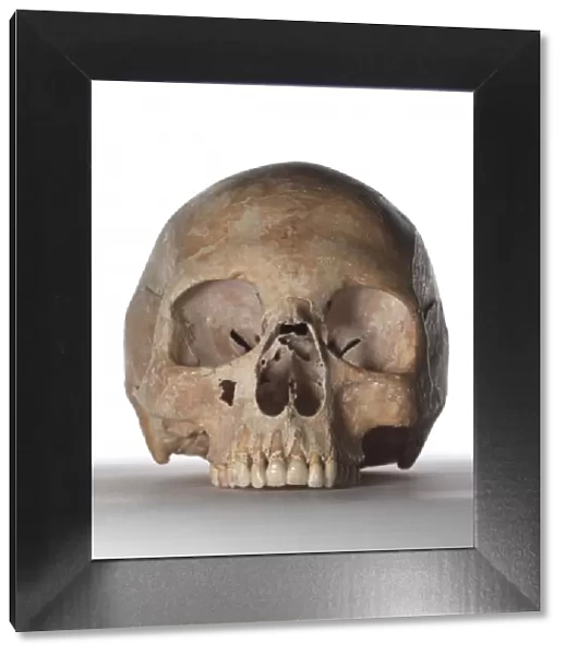 Modern human skull