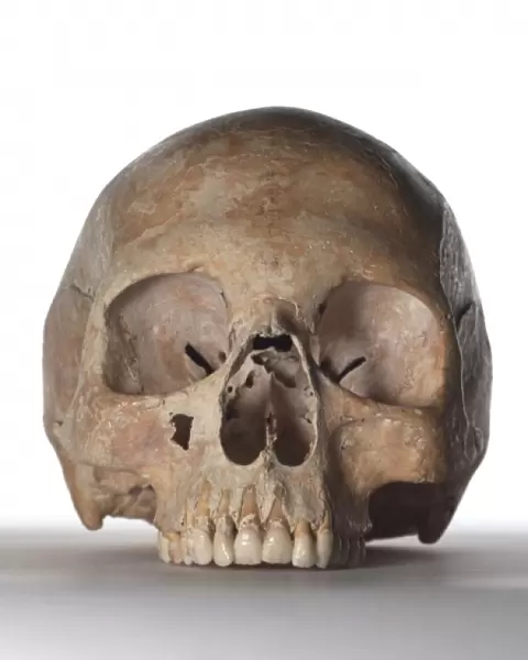 Modern human skull