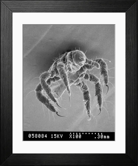 Framed Print : Pediculus humanus, human head louse Framed Print : Pediculus humanus, human head louse