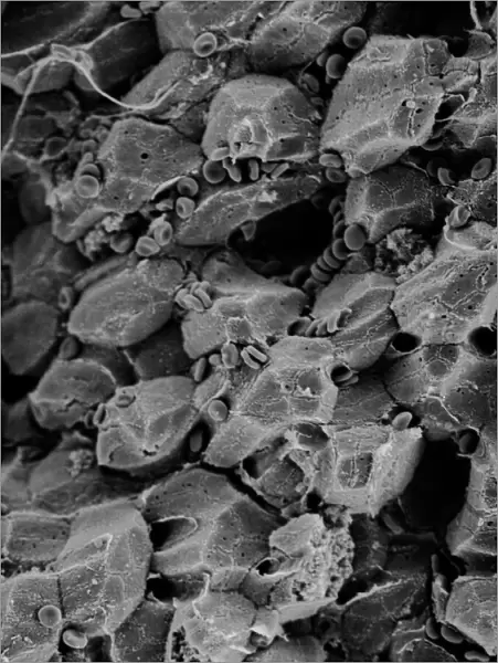 Liver. Scanning electron microscope (SEM) image of a section through a liver 