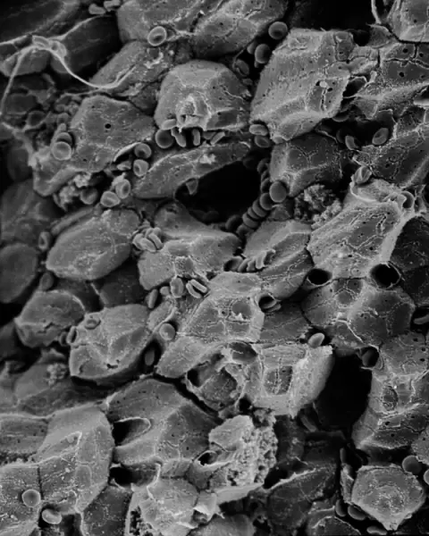 Liver. Scanning electron microscope (SEM) image of a section through a liver 