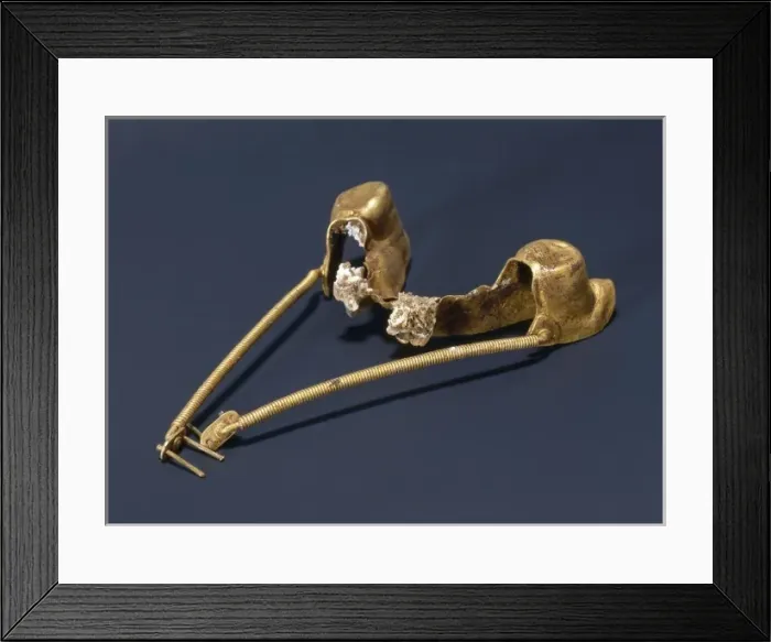 Framed Print : A gold lower denture Framed Print : A gold lower denture
