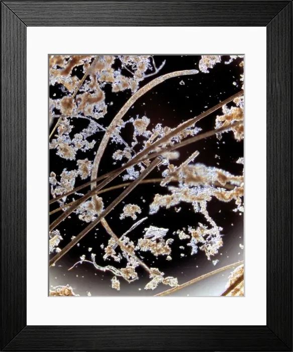 Framed Print : Trichinella spiralis, parasitic roundworm