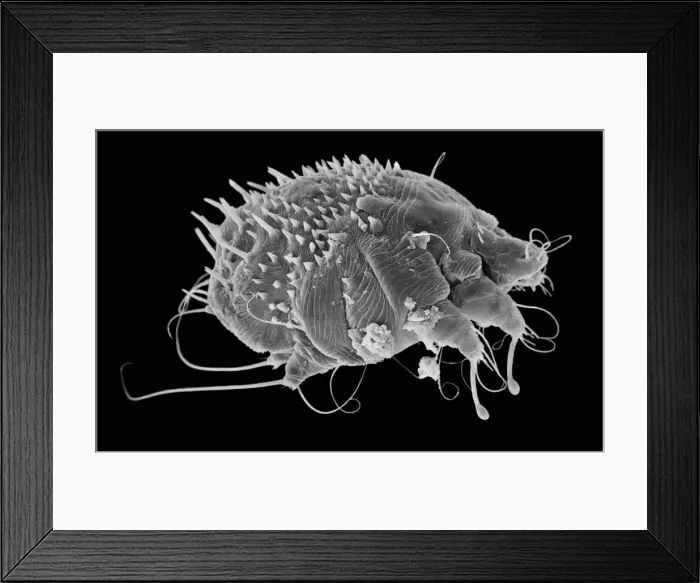 Framed Print : Sarcoptes scabiei, scabies mite Framed Print : Sarcoptes scabiei, scabies mite