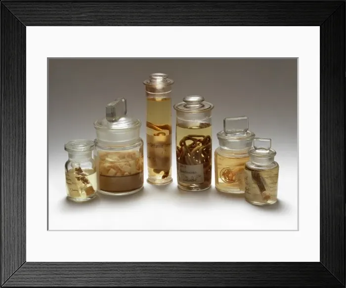 Framed Print : Parasitic worms Framed Print : Parasitic worms