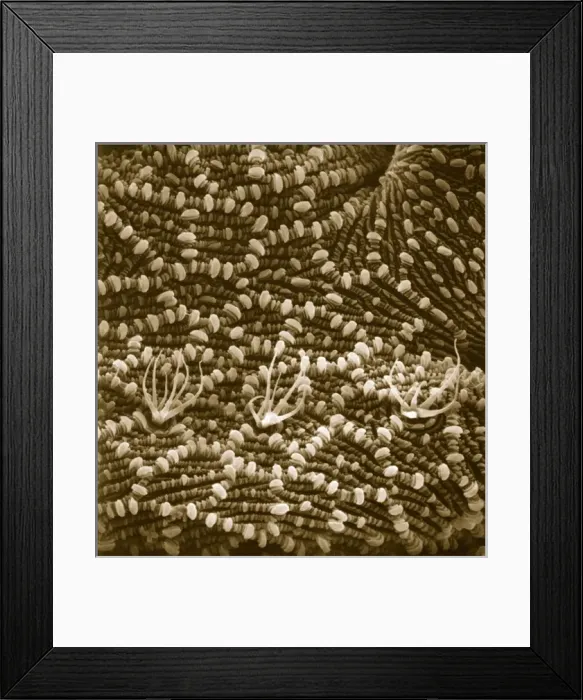 Framed Print : Ventral surface of a mite from the prostigmatic species Framed Print : Ventral surface of a mite from the prostigmatic species