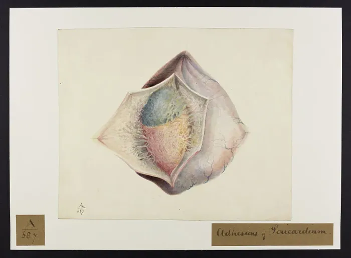 Framed Print : 13741385 Framed Print : 13741385