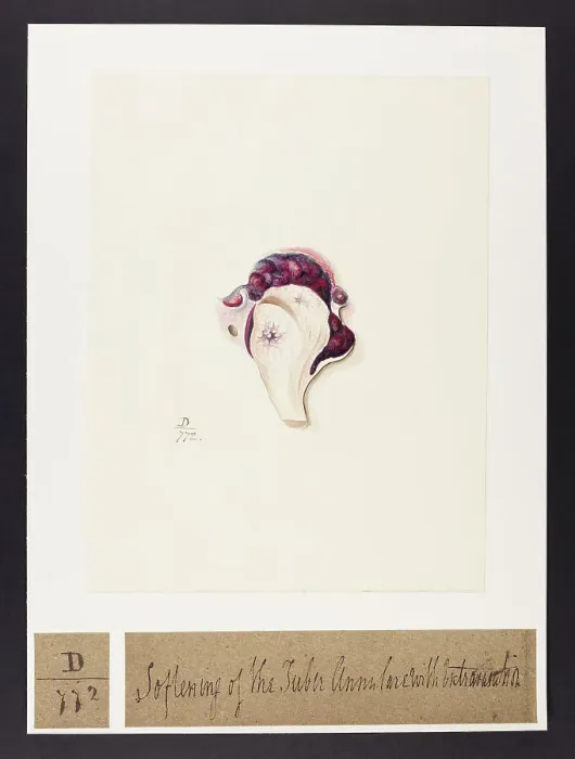 Framed Print : 13741695 Framed Print : 13741695