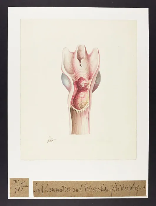 Framed Print : 13741752 Framed Print : 13741752