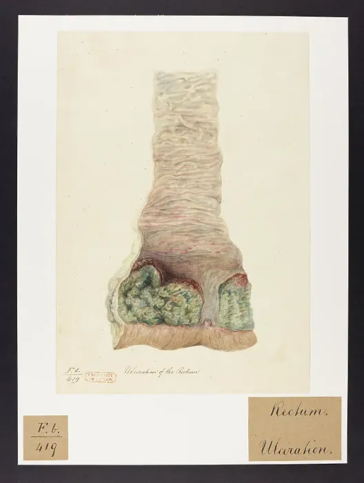 Framed Print : 13741808 Framed Print : 13741808