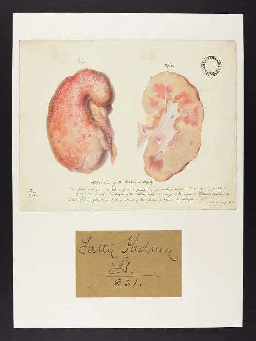 Framed Print : 13741975