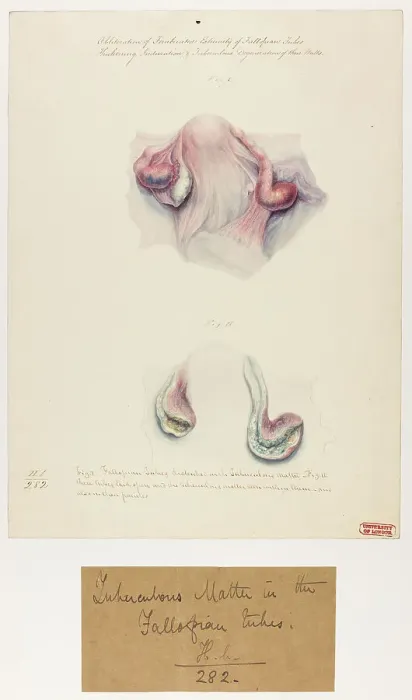 Framed Print : 13742021 Framed Print : 13742021