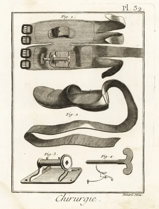Framed Print : 18th century knee pad 1, slipper 2, winch 3 and key 4 Framed Print : 18th century knee pad 1, slipper 2, winch 3 and key 4