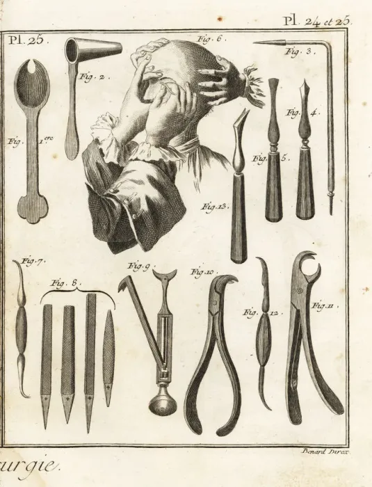 Framed Print : 18th century lacrimal gland operation and surgical equipment Framed Print : 18th century lacrimal gland operation and surgical equipment
