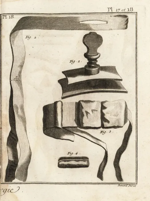 Framed Print : 18th century surgeon Jean Louis Petits screw-type Framed Print : 18th century surgeon Jean Louis Petits screw-type