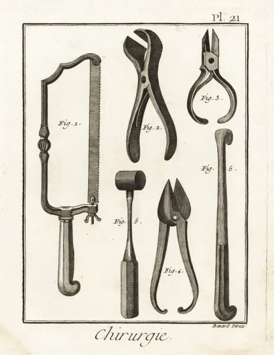 Framed Print : 18th century surgical equipment Framed Print : 18th century surgical equipment