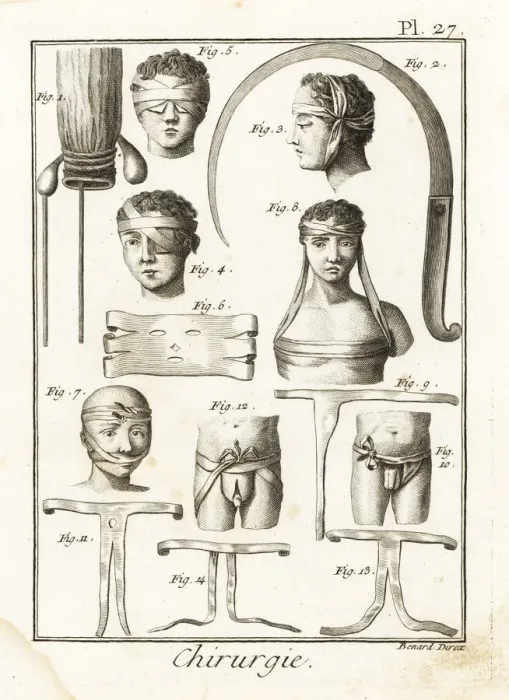 Framed Print : 18th century surgical equipment Framed Print : 18th century surgical equipment