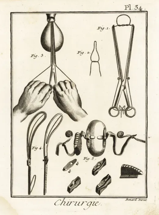 Framed Print : 18th century tweezers and speculum for obstetrics Framed Print : 18th century tweezers and speculum for obstetrics