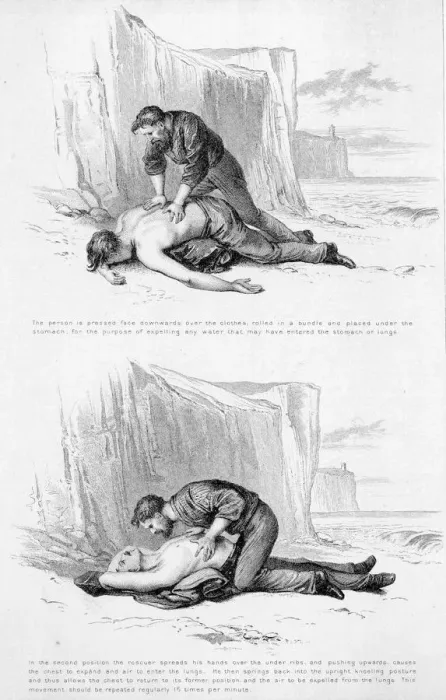Framed Print : ACCIDENTS / LIFE-SAVING Framed Print : ACCIDENTS / LIFE-SAVING