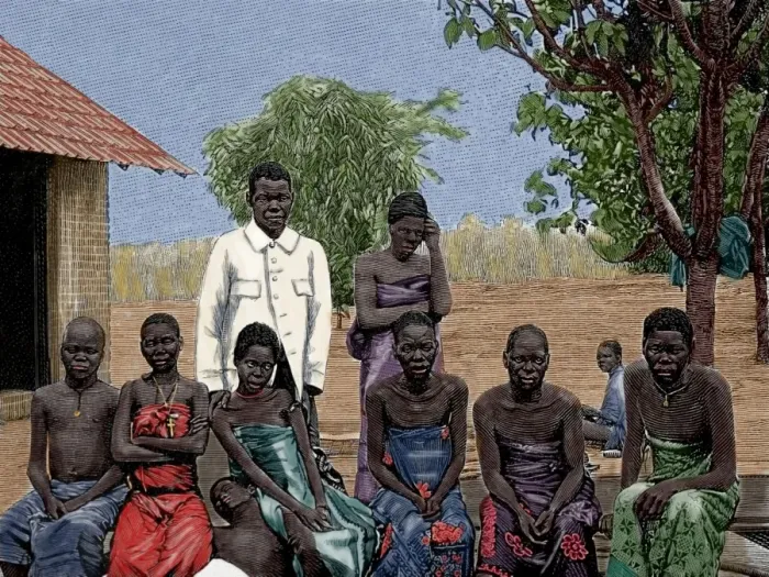 Framed Print : Africa. Native affected by sleeping sickness. Engraving by T Framed Print : Africa. Native affected by sleeping sickness. Engraving by T