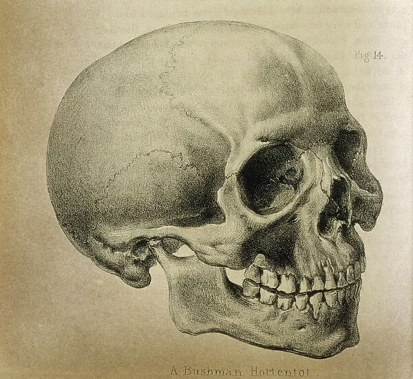Anatomy  /  Skull  /  1841