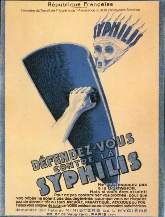 Framed Print : Anti-Syphilis Ad Date: 1930 Framed Print : Anti-Syphilis Ad Date: 1930