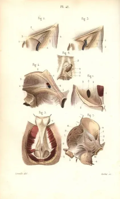 Framed Print : Aponeuroses of the abdomen and perineum Framed Print : Aponeuroses of the abdomen and perineum