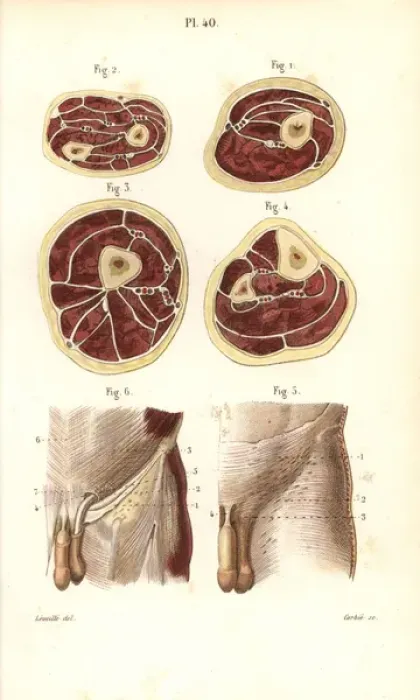 Framed Print : Aponeuroses of the torso in cross-section Framed Print : Aponeuroses of the torso in cross-section