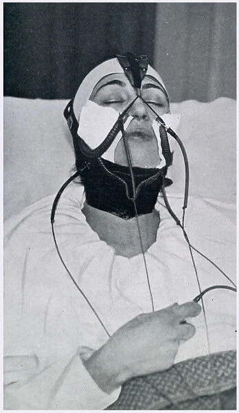 Apparatus for the Removal of the Double Chin 1927